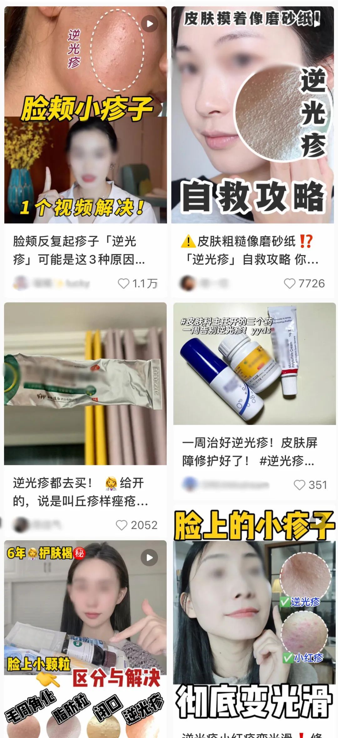 脸上疙疙瘩瘩但不是闭口,脸上疙疙瘩瘩是闭口吗