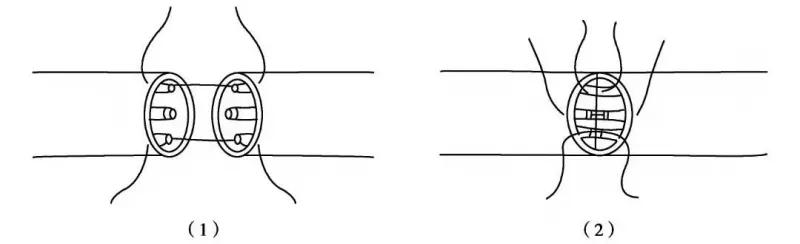 修复神经的最好方法,神经修复的最佳时间表