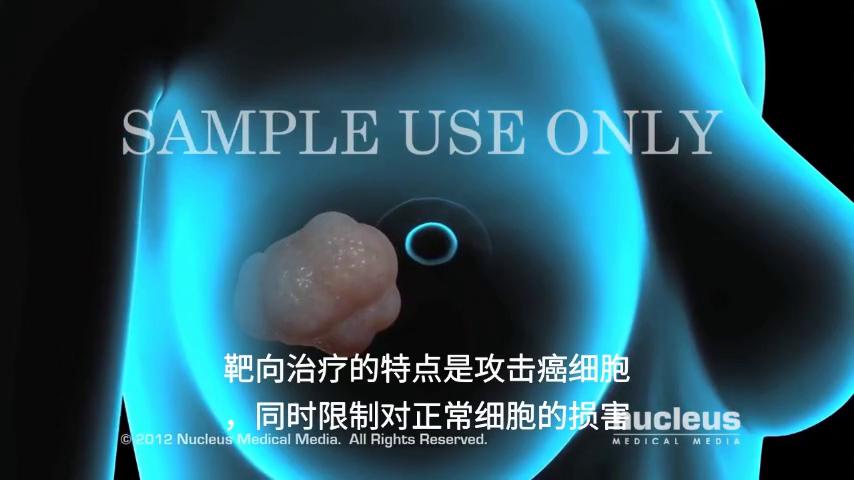 肺部鳞状肿瘤靶向治疗,什么是肿瘤靶向治疗