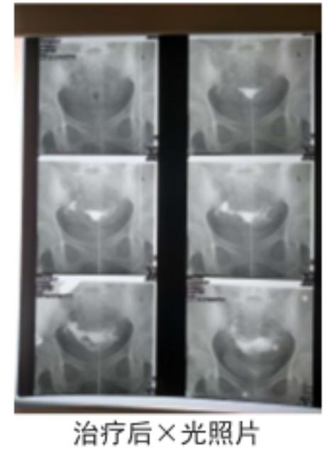 28岁备孕二胎一直不孕是怎么回事,38岁二胎不孕怎么回事