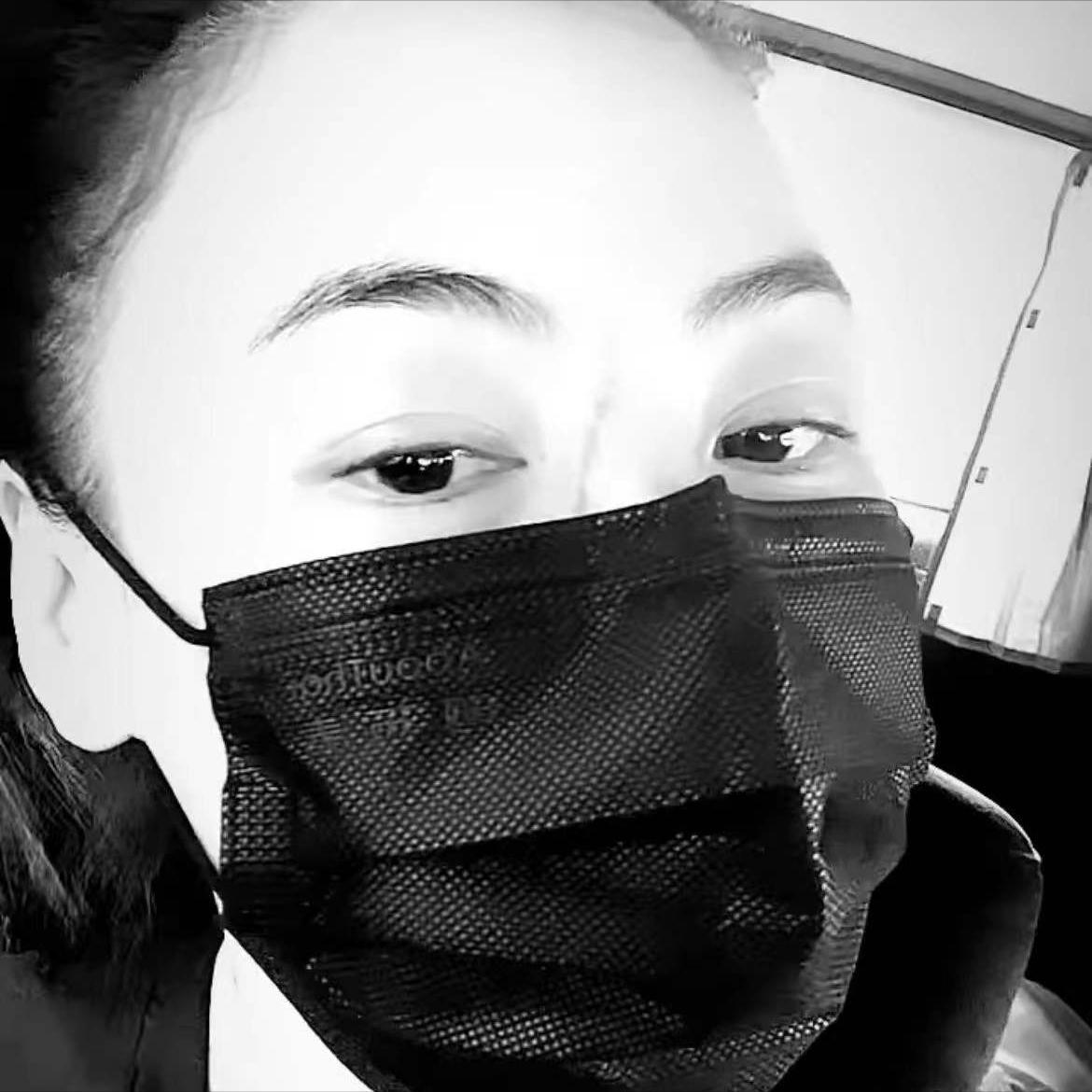 张柏芝被宠物狗咬脸,张柏芝小儿子受伤