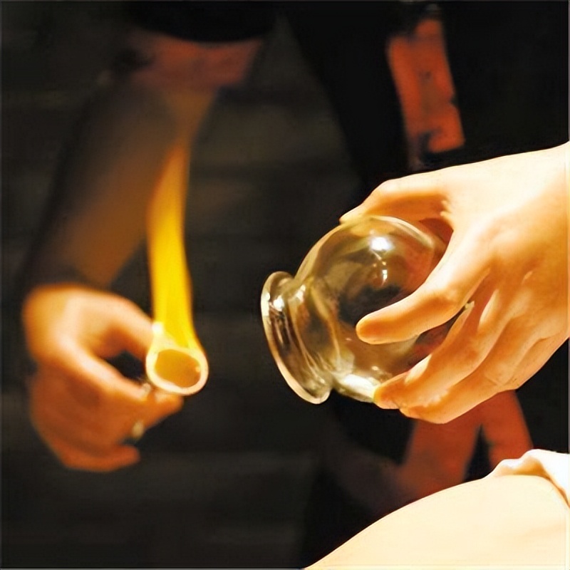 老中医拔火罐的正确方法,中医提醒拔火罐警惕四个禁忌