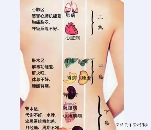 脾湿犯困怎么调理,脾虚湿盛犯困吃什么中成药