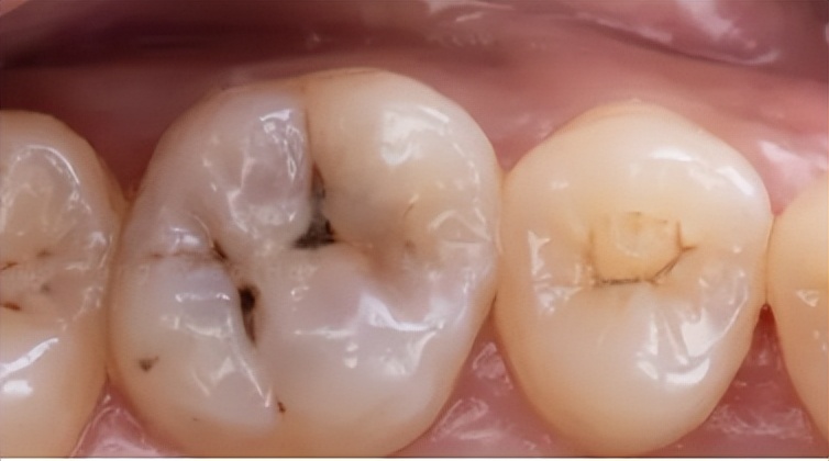艾优和飞利浦儿童电动牙刷测评,飞利浦和usmile儿童电动牙刷测评