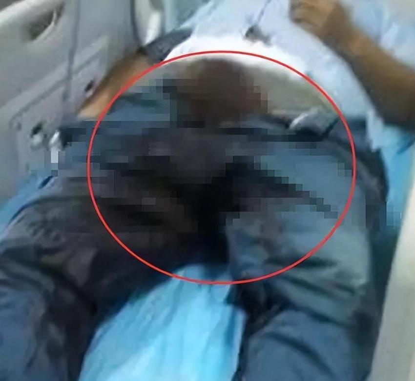 激情过后，广西一女子竟割掉男友的生殖器，上演现实版“阉割”