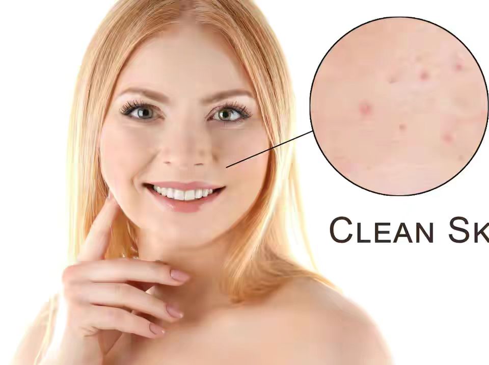 你因*疮痤**焦虑自卑？日常做好这2件事，也能拯救你的“*疮痤**脸”