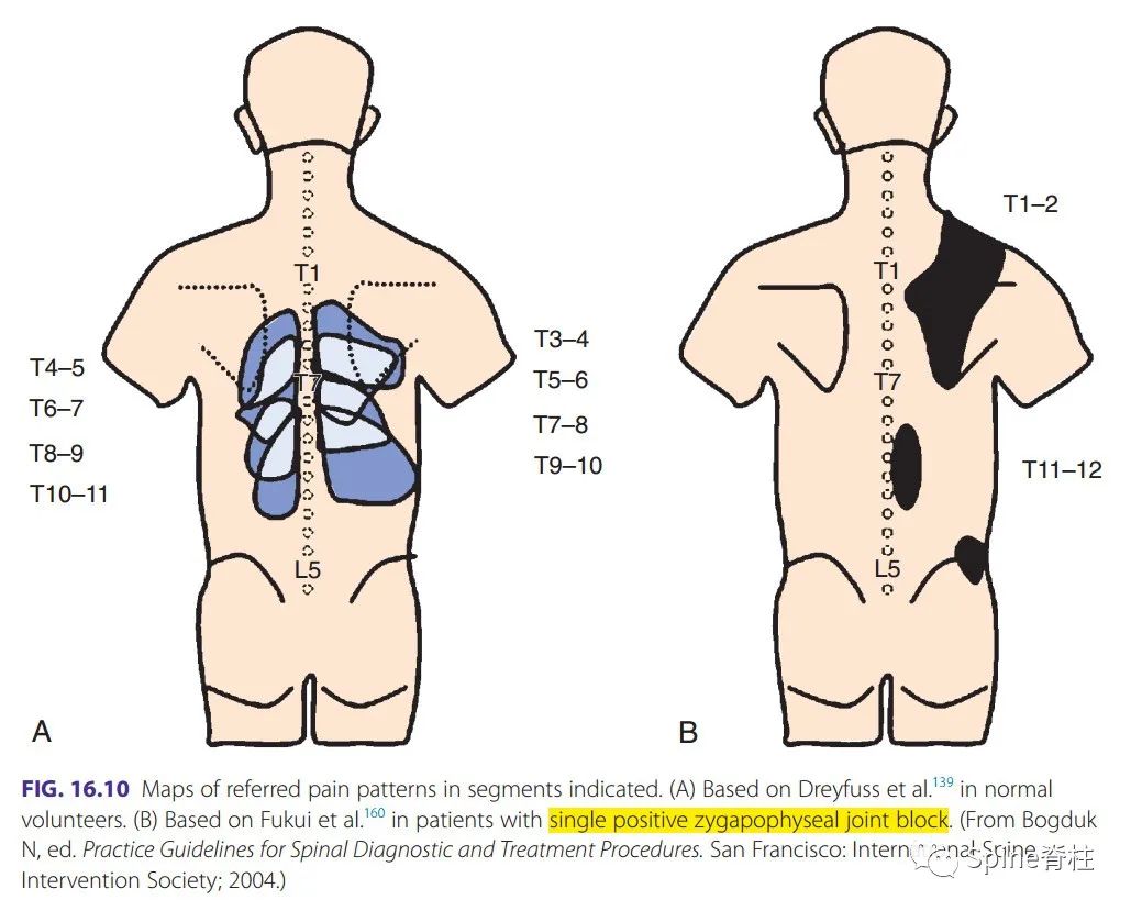 脊柱神经支配疼痛区域,脊柱神经支配的脏腑