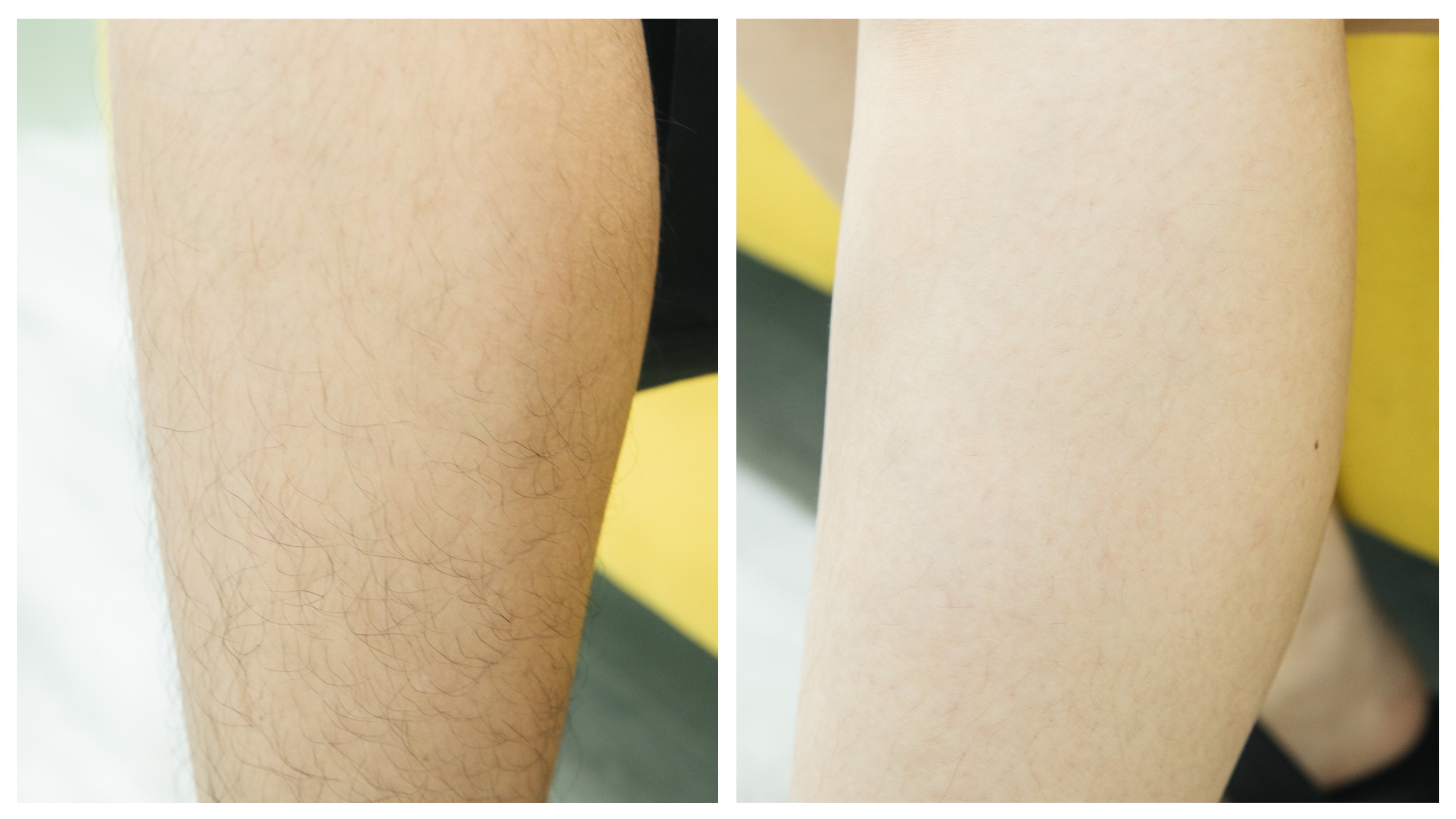 网上脱毛仪是不是智商税,脱毛仪到底是黑科技还是智商税