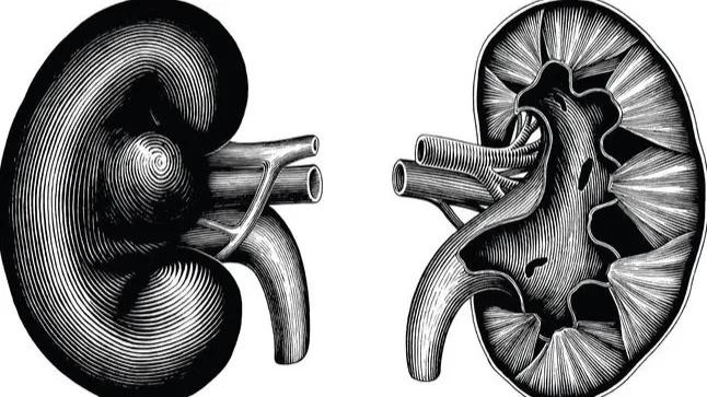 高血压肾病出现尿液减少,小腿浮肿是高血压肾病的症状吗