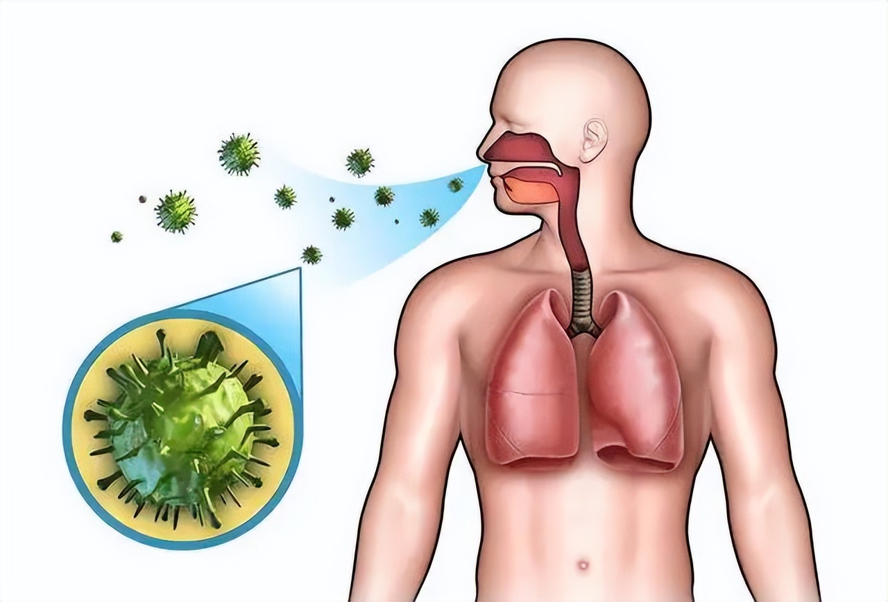 肺部黄痰与白痰区别,痰在肺部怎么形成的