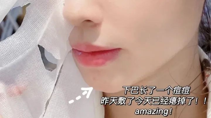 2021美白淡斑面膜十大排行榜口碑,美白祛斑补水保湿面膜测评