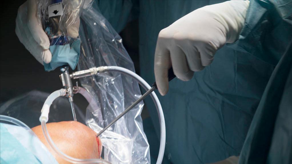 髌骨软化上楼膝盖疼能治好吗,髌骨软化症下楼梯膝盖疼怎么回事