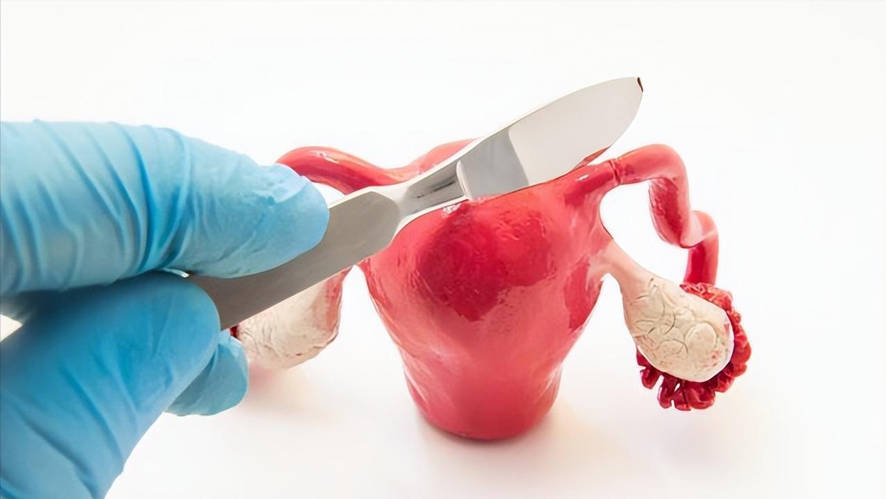 直肠癌的4个身体暗示需要警惕,直肠癌多半是拖出来的