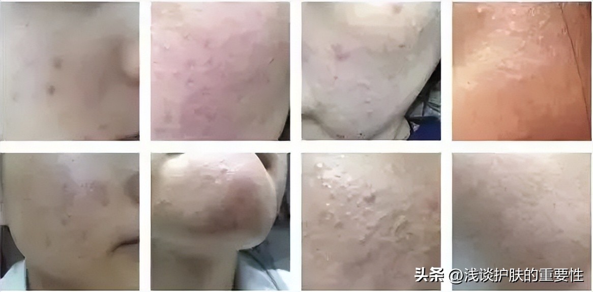 秋冬换季，种草这些护肤让你肌肤水润透亮