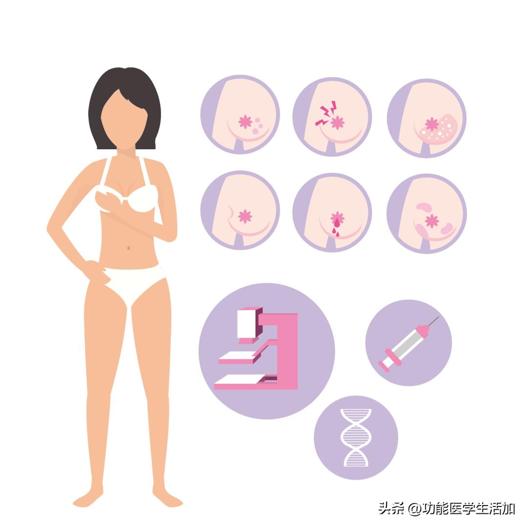 乳腺增生治疗费用大概多少,乳腺增生和囊肿需要治疗吗