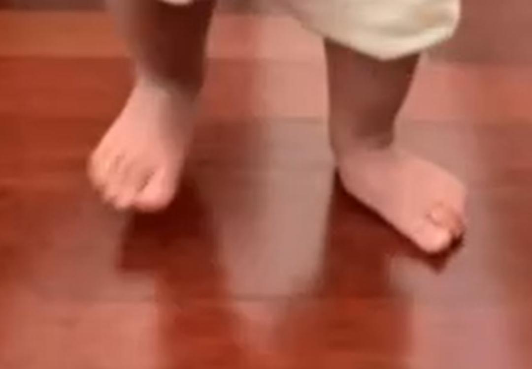 1岁宝宝不愿走路总是要爬怎么办,2岁宝宝一只脚扁平足怎么办