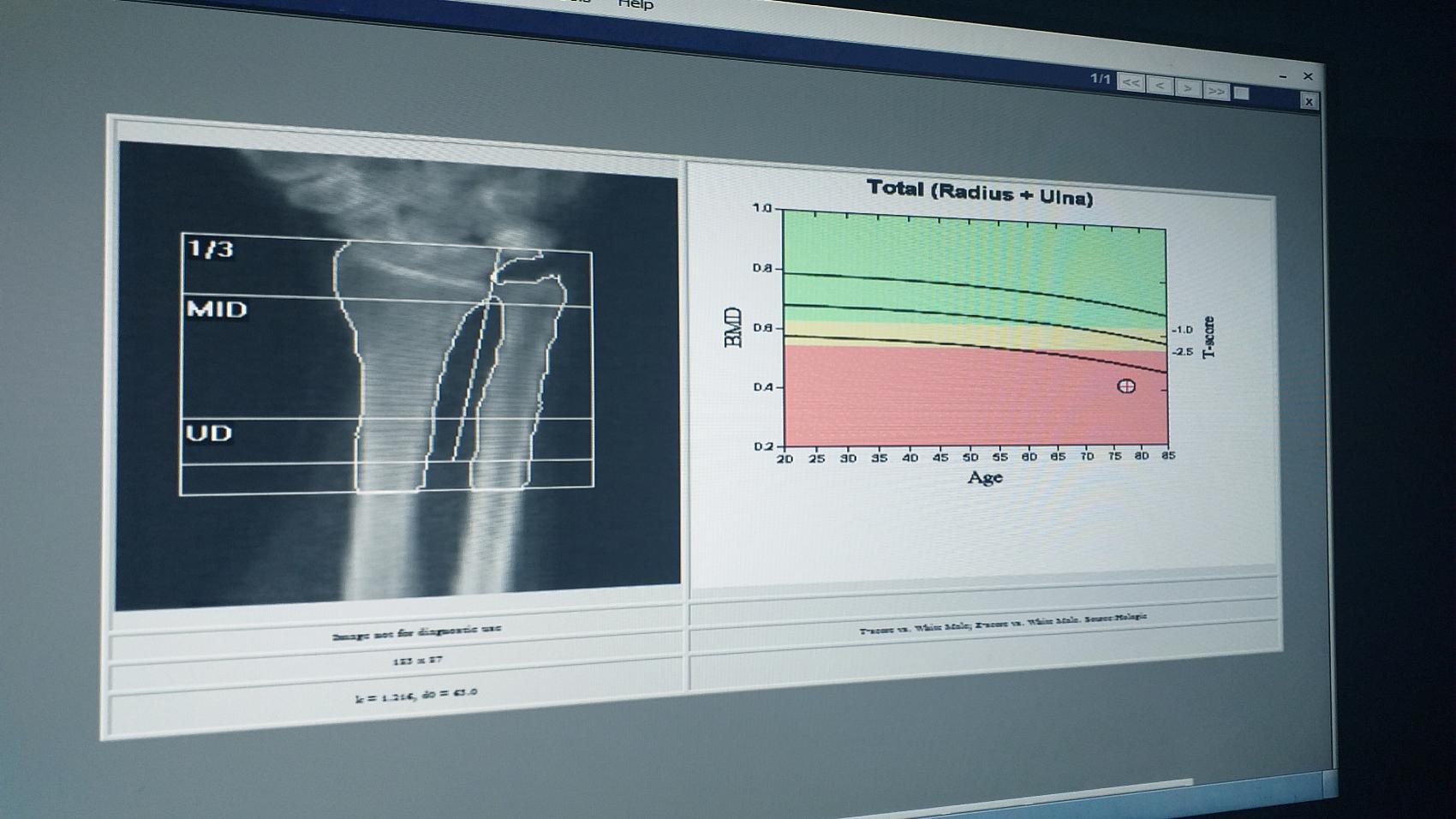 五六十岁的体检要做哪些项目,五六十岁检查身体哪些项目