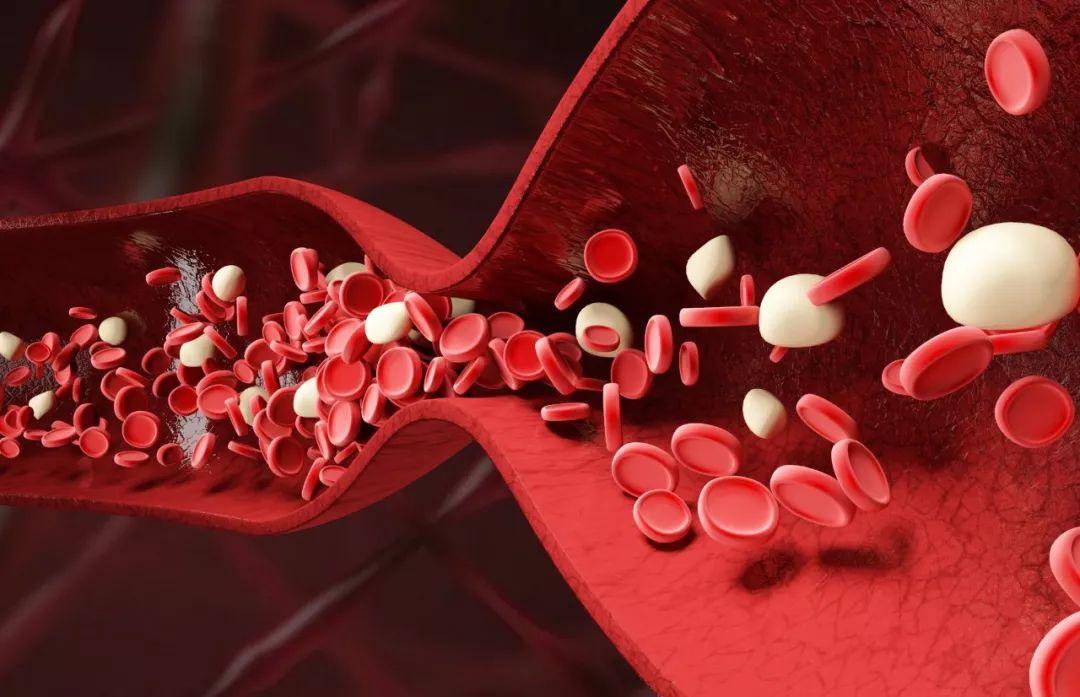 舌下有青筋就是有血瘀吗,舌下青筋是血瘀体质的症状