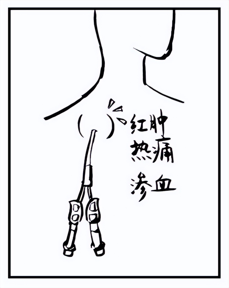 疫情下的血透室守护患者的生命线,血透病人怎么保护自己的生命线