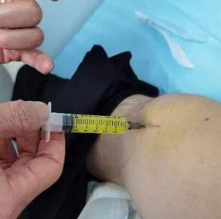 “一针扎进去，关节液自动流出来了”，过完年，这种病又开始发作了…