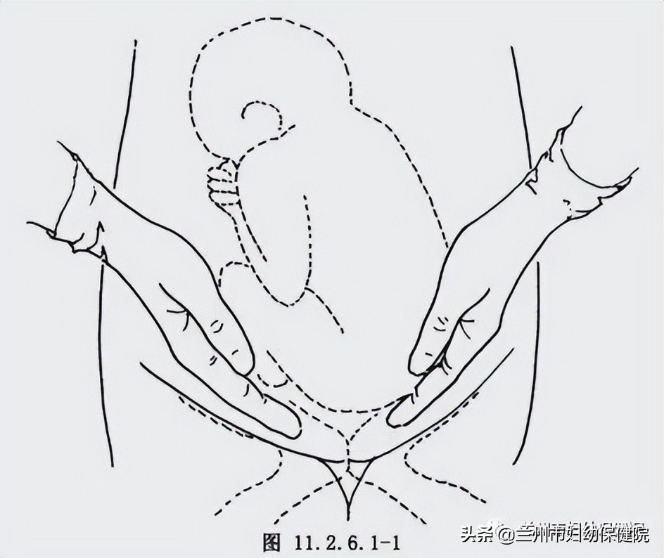 妇产科大夫乾坤大挪移,南京市妇幼臀位倒转术