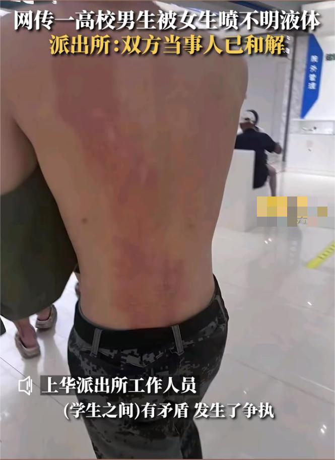 浙江师范大学行知学院男生被烫伤,浙江师范大学行知学院烫伤事件