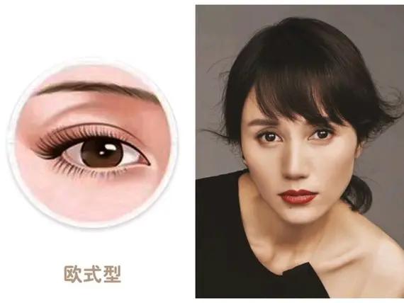 整形科普知识修复双眼皮,双眼皮整形有哪些常见方法