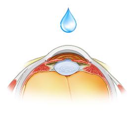 TrefoilTherapeutics获第三批2800万美元A轮融资