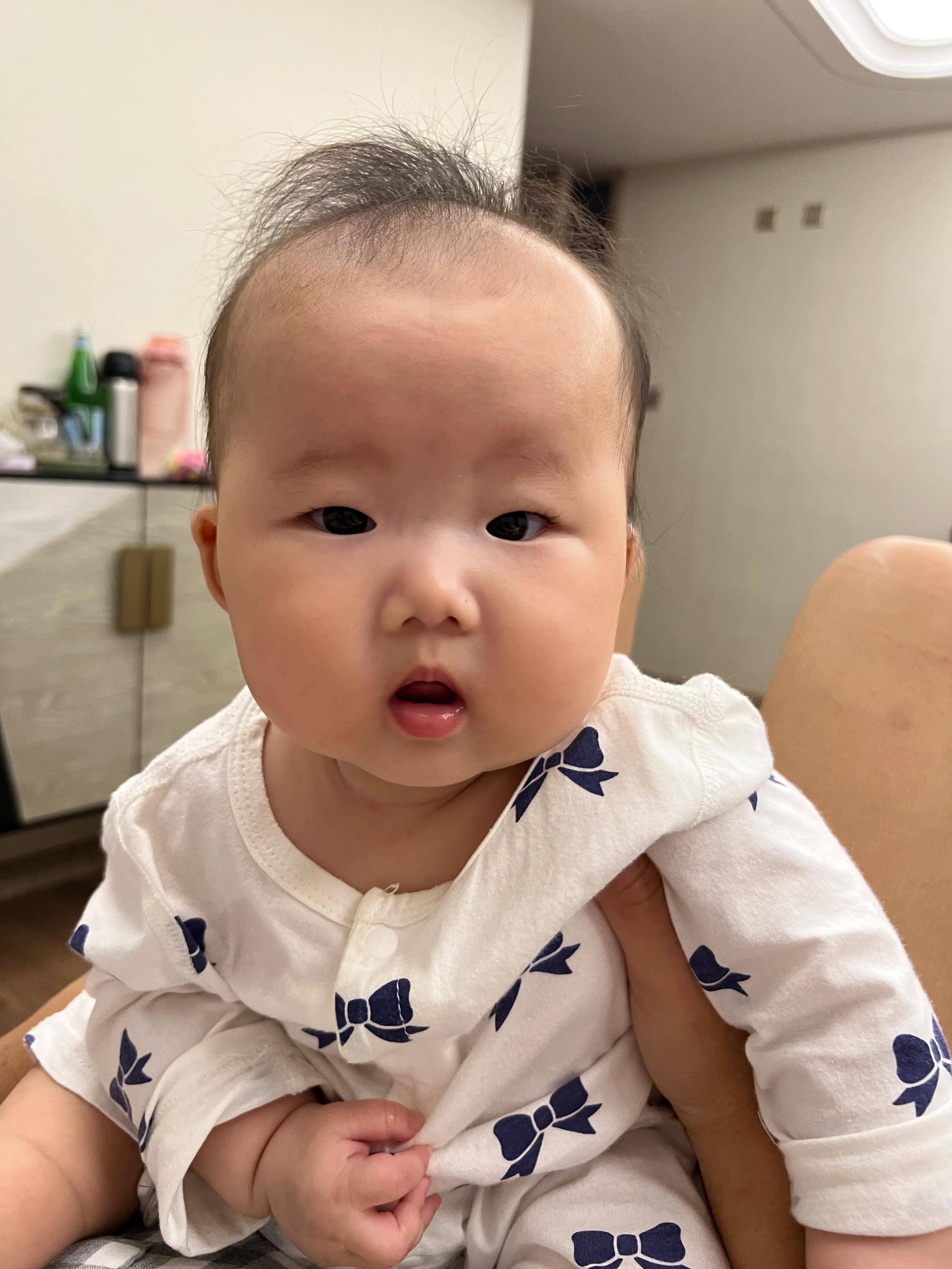 女儿四岁了头发很少,新生儿头发稀少还有必要剃胎毛吗