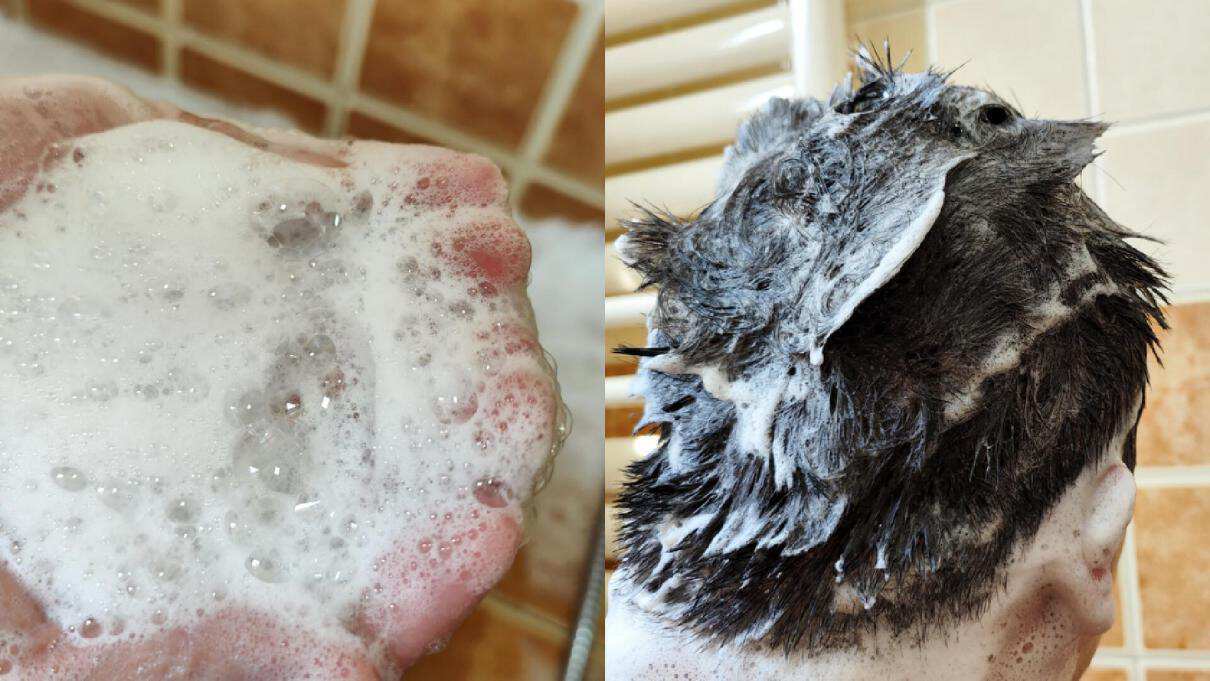 去头皮屑防掉发的洗发水推荐,脱发痒用哪一款洗发水比较好