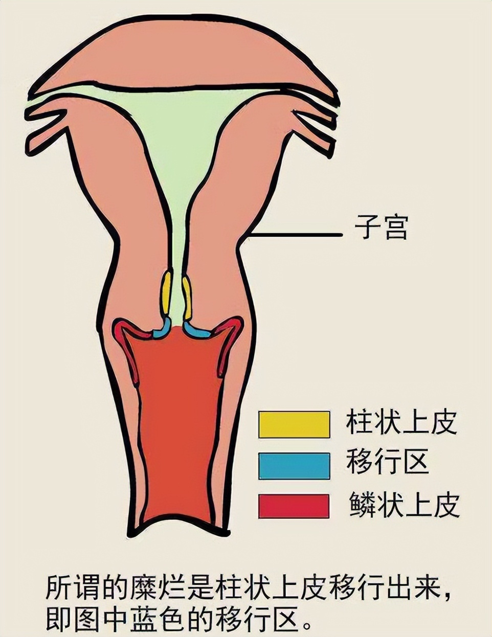女子下身检查疼痛难忍,女性突然腹痛查出盆腔出血