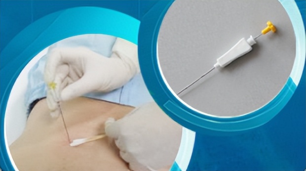 压力性尿失禁全攻略,压力性尿失禁最新指南