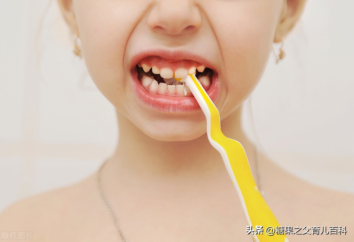 儿童蛀牙保健知识,宝宝蛀牙怎么补救动画