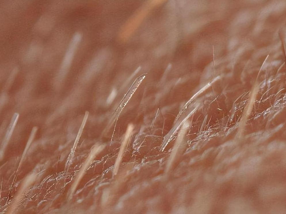 阴毛变白，警惕这2大原因！*处私**毛发的秘密别羞于查看