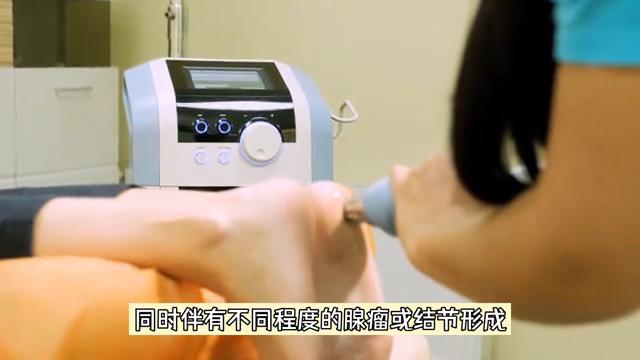 原发性醛固酮增多症发病机制图,原发性醛固酮增多症诊断和治疗