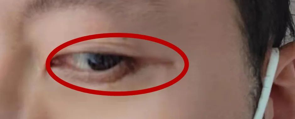 南京施尔美整形医院正规吗,南京施尔美整形整容医院失败案例