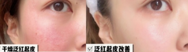 怀孕不能用的护肤品品牌,孕妇可以用的水乳有哪几个品牌