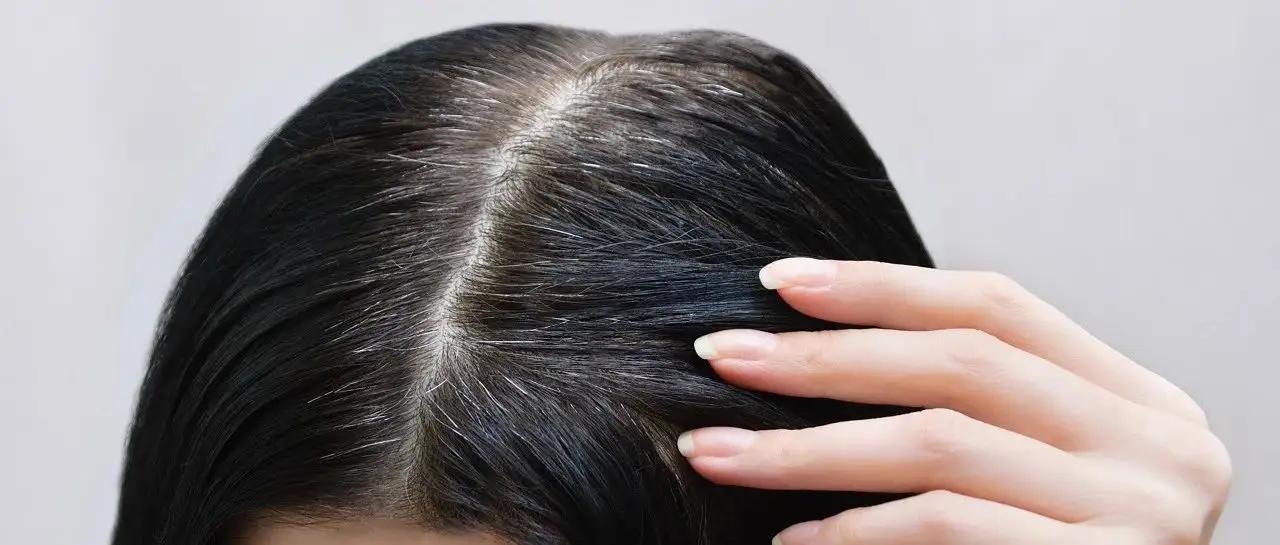 女性白头发是体内缺乏什么东西,女性白头发吃什么改善