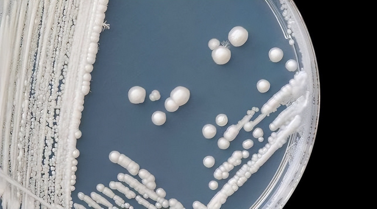 金黄色葡萄球菌的微生物特性,金黄色葡萄球菌的培养特性