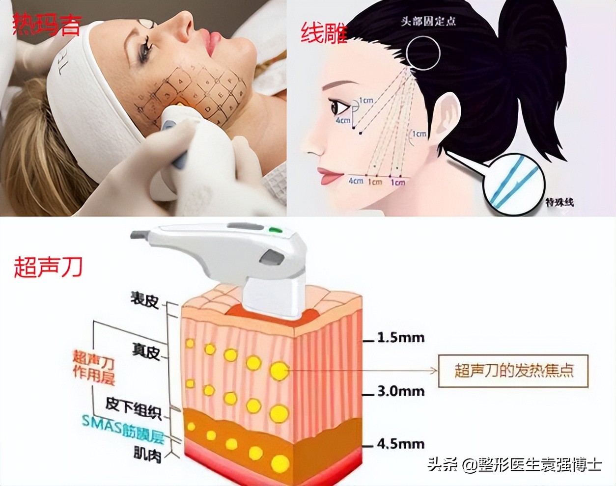 40岁女人脸要怎么保养去法令纹,40岁男士法令纹最新消除法