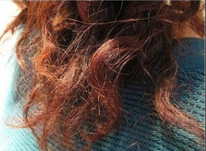 染发过程中头皮刺痛正常吗,染发过程中头皮痒正常吗