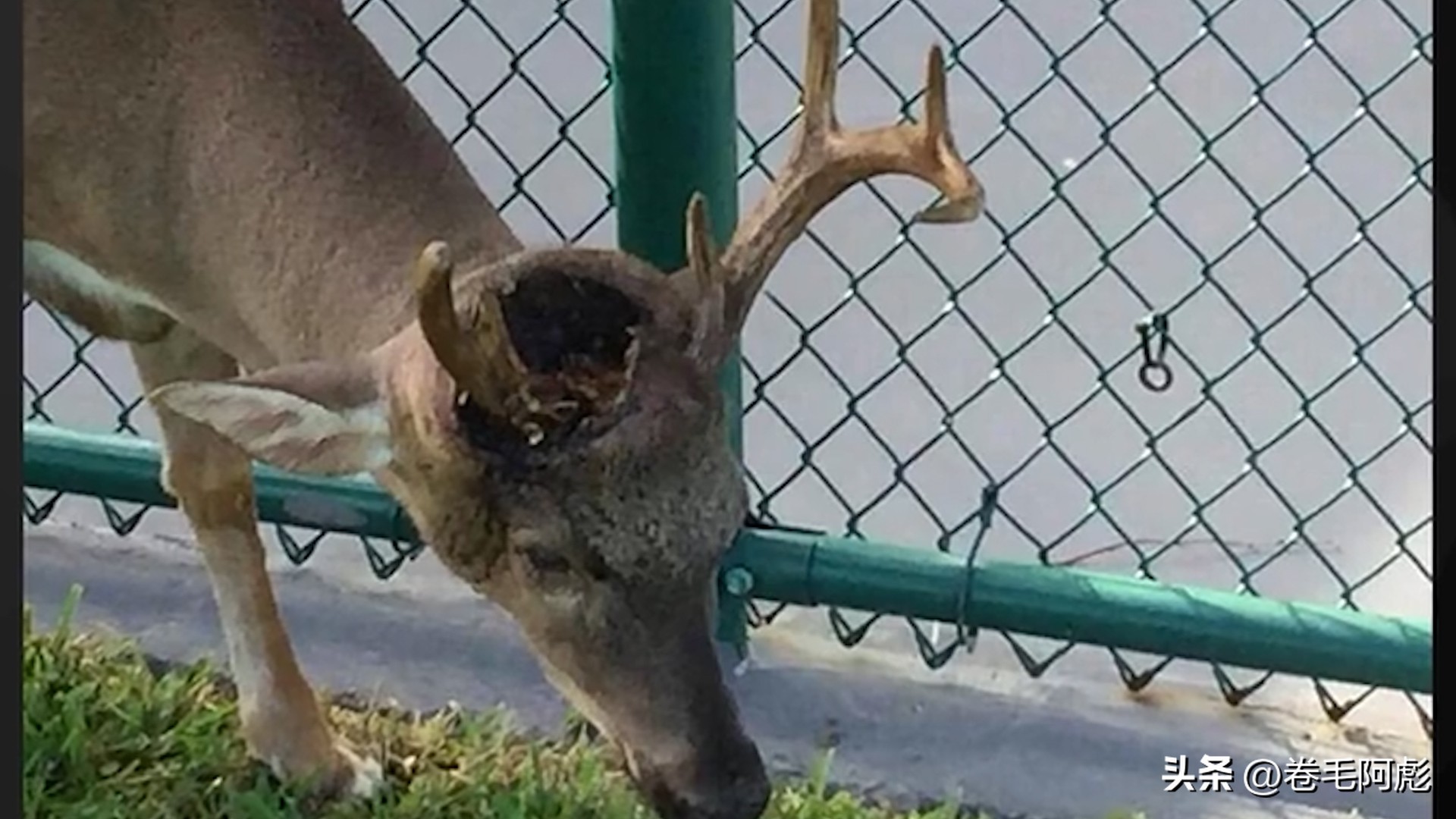 女子被12只蜱虫咬,美国女子被虫子咬