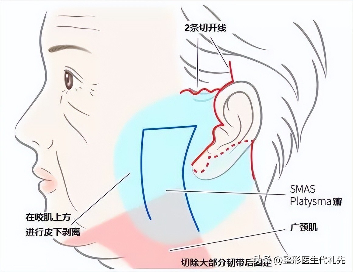 面部抗衰老的黄金三步（医生总结），40~50~60不同年龄阶段抗衰老