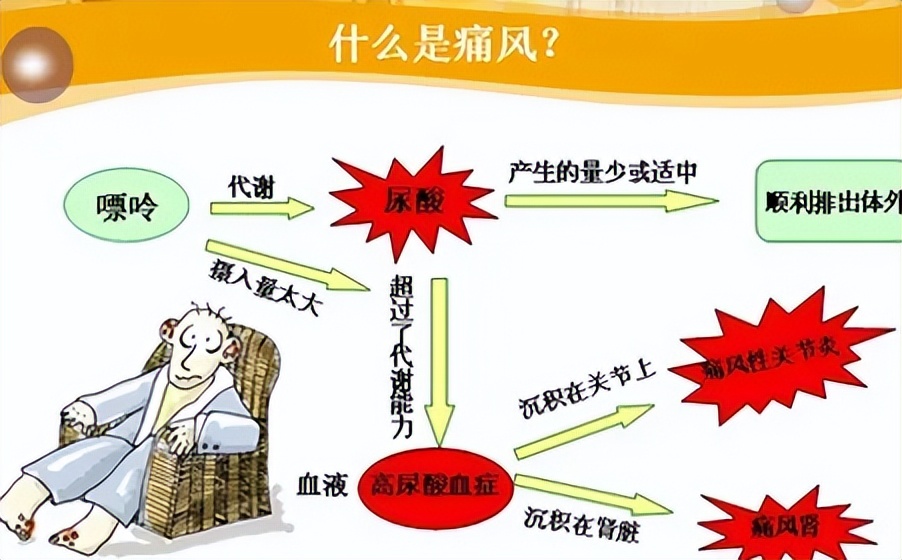 尿酸高为什么能喝茶不能喝咖啡,尿酸高及痛风与常年喝茶有关系吗