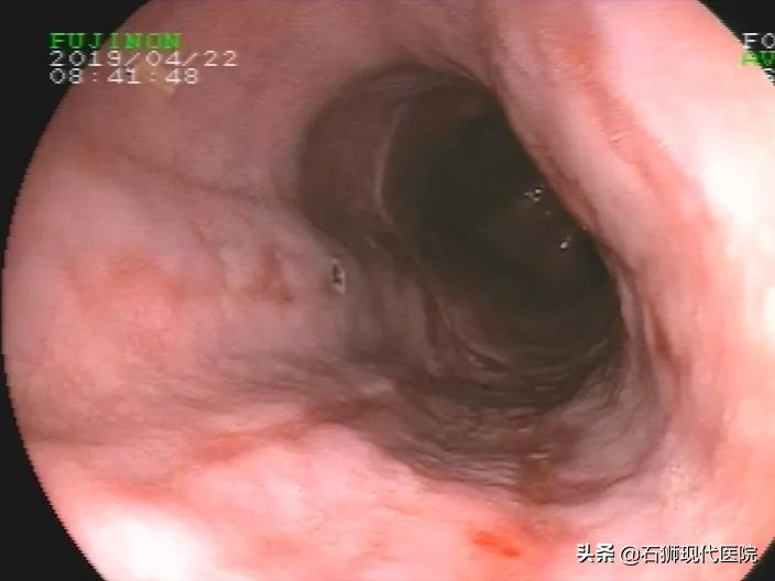 有哪些人不合适做胃镜,石狮市医院做胃镜肠镜技术可以吗