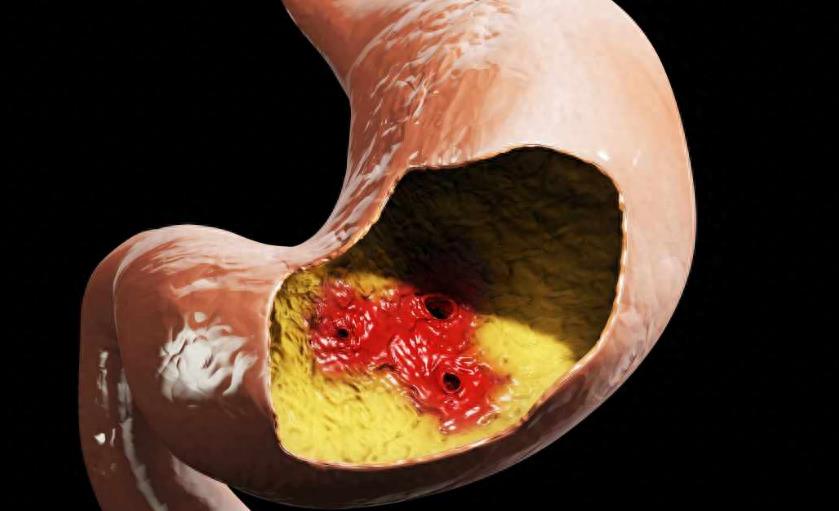 有钱人意外事故死亡,曝光现在年轻人为什么生病