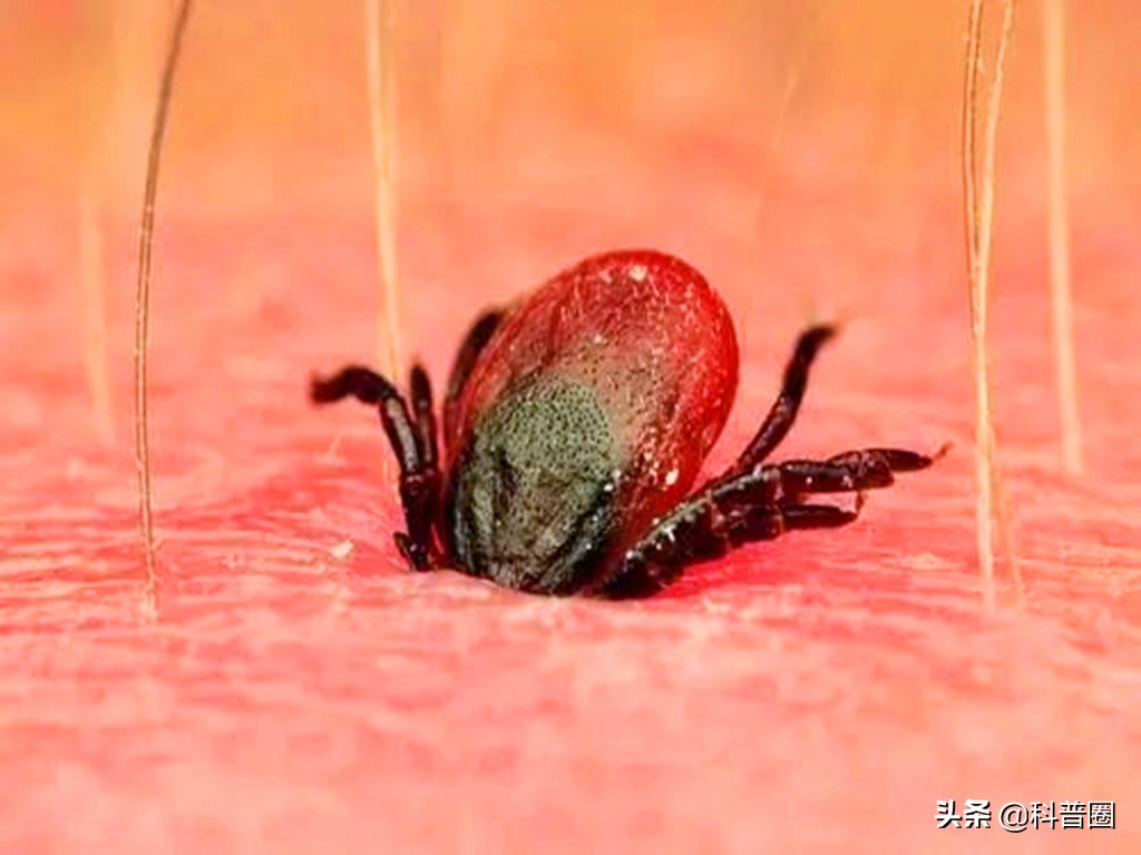 致命蜱虫,比蜱虫还可怕