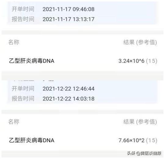 拉米夫定耐药换恩替卡韦,以前吃拉米夫定后改用恩替卡韦