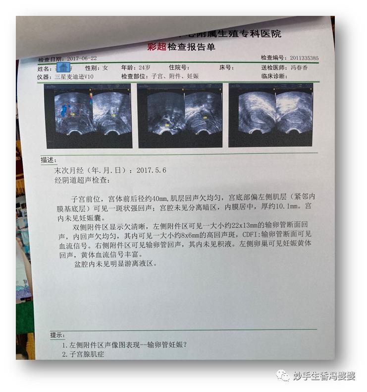 宫外孕后再怀孕容易胎停流产,宫外孕胎停怎么处理