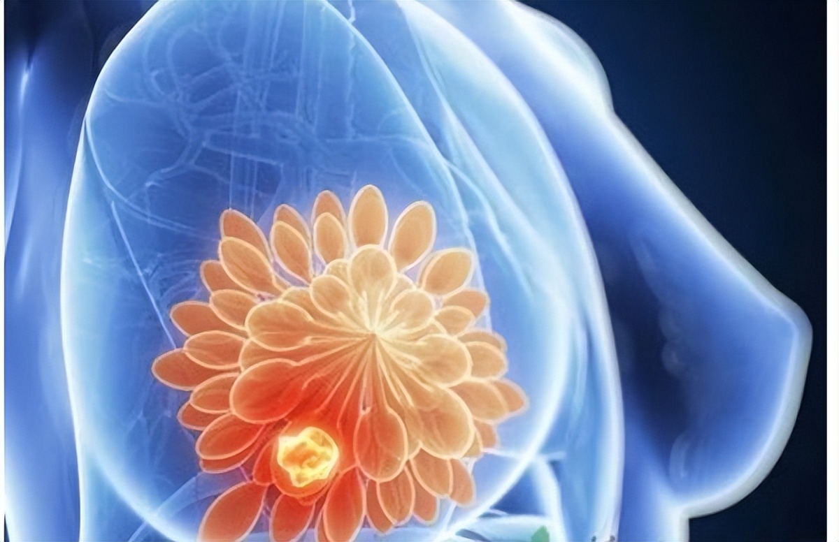 张锡纯方子一钱是多少克,张锡纯治结节方子